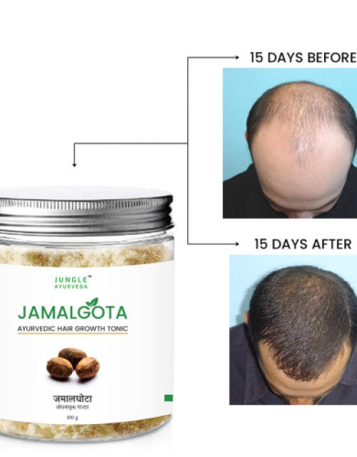 Jamalgota Powder for Hair Growth, Natural Skin & Hair Solution ( Pack Of 2 )